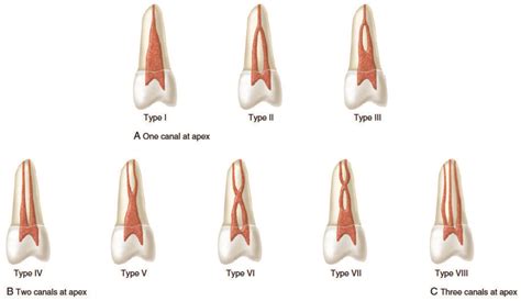 Maxillary First Premolar Canals