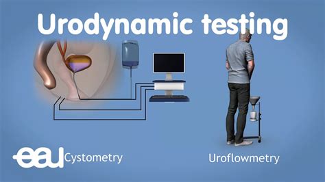 Urodynamics for overactive bladder - YouTube