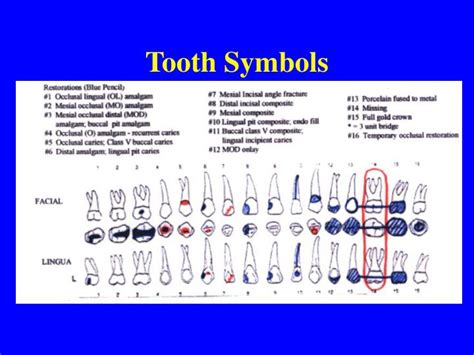 PPT - Dental Charting PowerPoint Presentation - ID:1282644