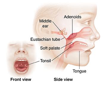 Tonsillectomy/Adenoidectomy | Saint Luke's Health System