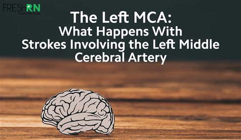 Left MCA Strokes: What Happens With Strokes Involving the Left Middle Cerebral Artery – FRESHRN