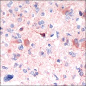 Anti-GFAP antibody, Rabbit monoclonal - Glial fibrillary acidic protein