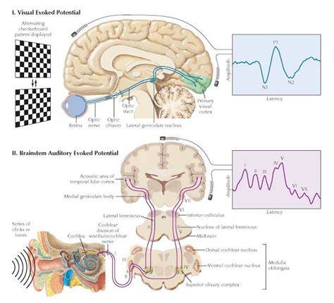 VISUAL AND AUDITORY EVOKED POTENTIALS | Brain anatomy, Nervous system, Visual