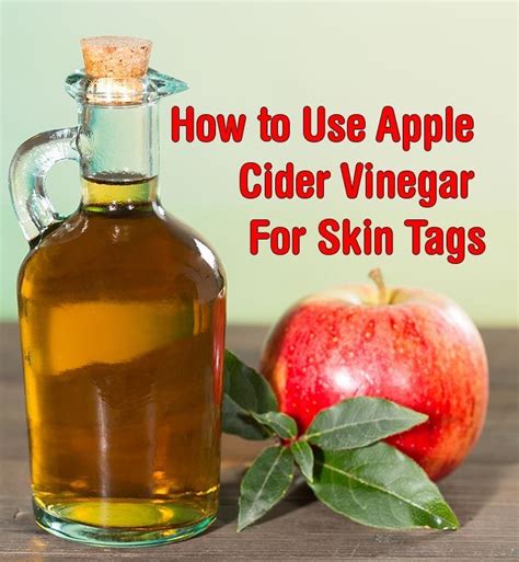 How to Use Apple Cider Vinegar For Skin Tags - Healthy Focus