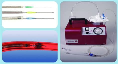 The Penumbra system for thrombus aspiration. Provided courtesy of... | Download Scientific Diagram