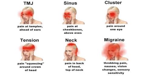 10 Alarming Headache Signs and Symptoms That You Mustn't Ignore