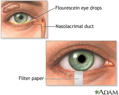 Schirmer test Information | Mount Sinai - New York