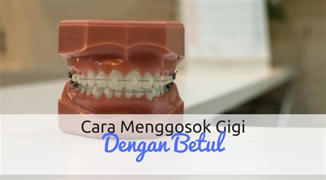 Cara Menggosok Gigi Dengan Betul - Wikicara