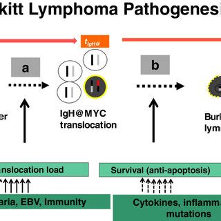 (PDF) Burkitt Lymphoma: Beyond discoveries