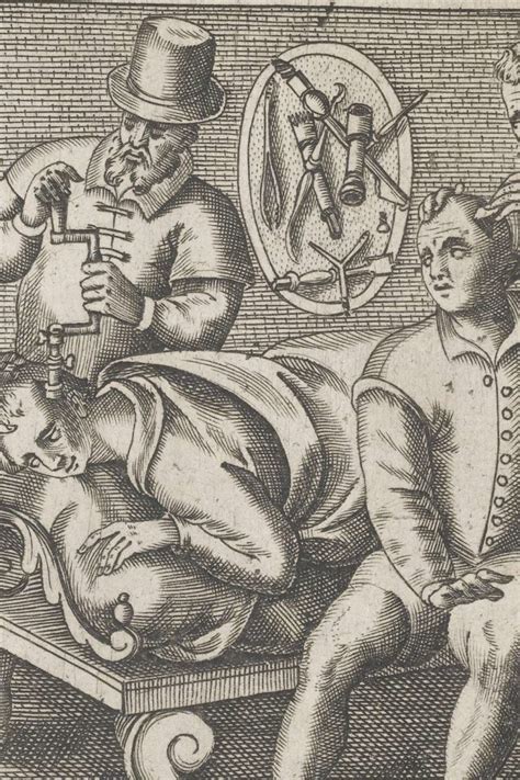 Trepanation: Our ancestors' idea of neurosurgery