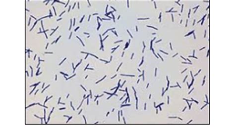 Microscopic view of showed gram positive rod shaped Lactobacillus. | Download Scientific Diagram