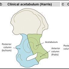 Anatomical definitions depicted on a right hemi pelvis, lateral view a... | Download Scientific ...