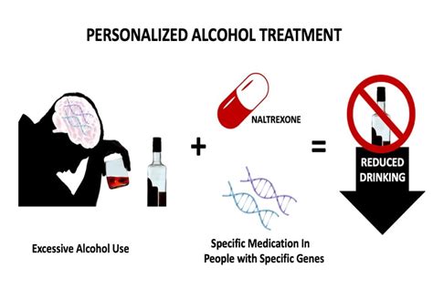 Three genes predict success of naltrexone in alcohol dependence treatment | MUSC | Charleston, SC