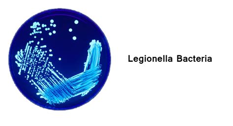 Legionella Bacteria - Cleanup Tips