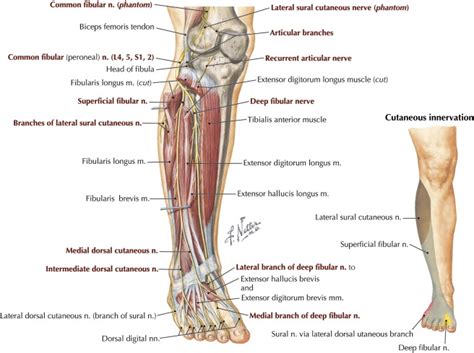 Common Peroneal Neuropathy