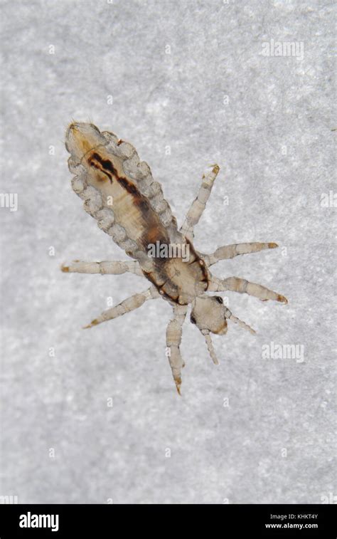 Body louse skin microscope hi-res stock photography and images - Alamy