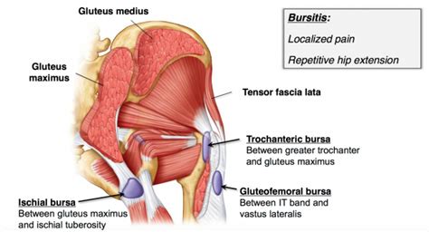 Ischial Bursitis Archives - San Diego Running & Sports Injury Clinic