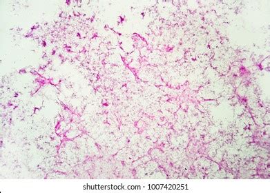 Actinomycetes Under Microscope Stock Photo 1007420251 | Shutterstock