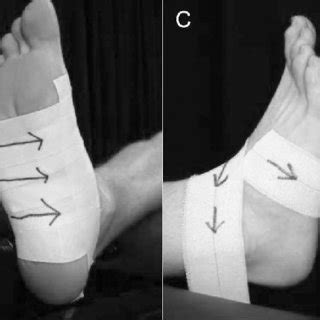 Taping techniques. Low-dye technique: A, an anchor strip around the... | Download Scientific Diagram