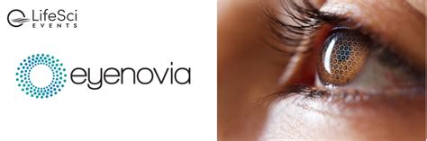 Eyenovia: A Potential Advancement for In-Office Pupil Dilation Using Eyenovia's Platform ...