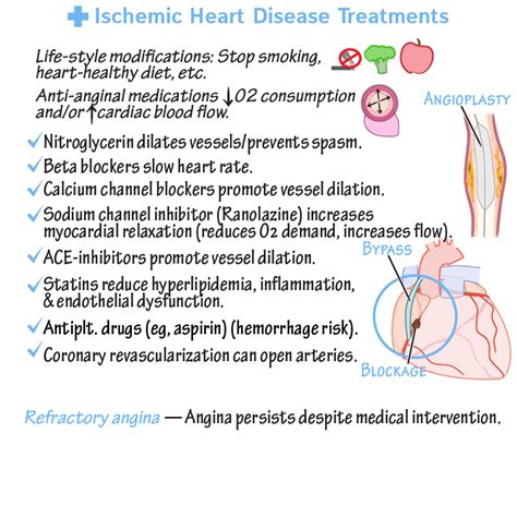 Pathology Glossary: Ischemic Heart Disease Treatments | Draw It to Know It