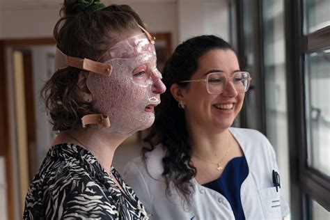 Treating Children With Severe Burns Using Face Masks Produced With 3D ...