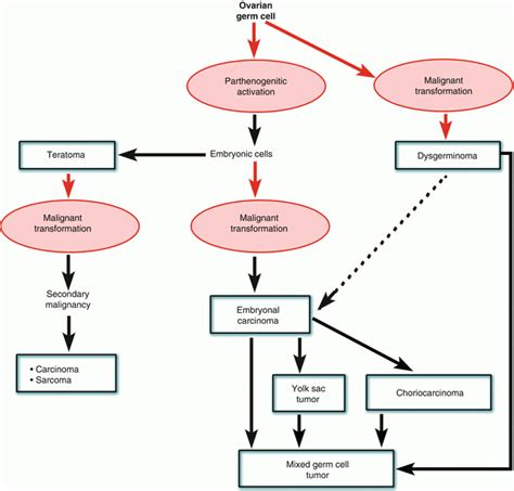 Germ Cell Tumors: Classifications, Definitions, and Terminology | Basicmedical Key