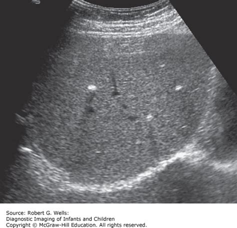 The Hepatobiliary System | Obgyn Key