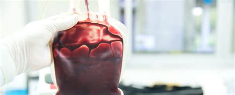 Your Blood Type Can Seriously Hurt Your Chances of Surviving a Deadly Injury « AuroBlog ...