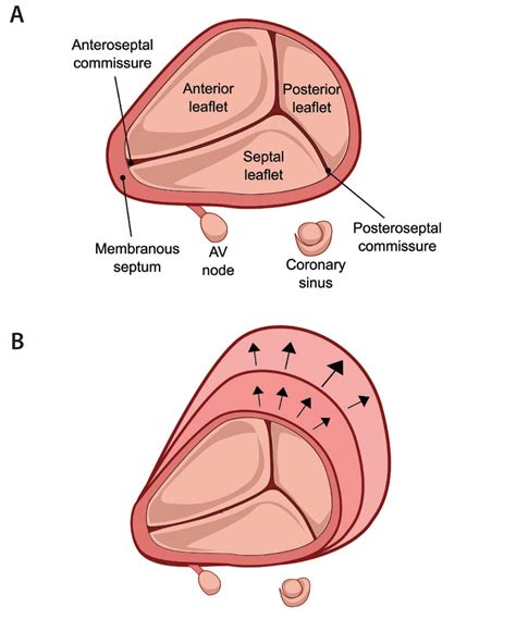 Tricuspid Valve