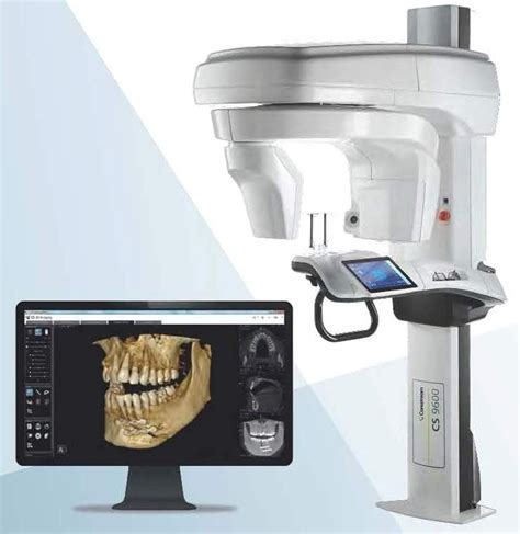 CBCT Imaging (Cone Beam Computed Tomography) Webster TX, Oral Surgery Associates