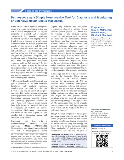 (PDF) Dermoscopy as a Simple Non Invasive Tool for diagnosis and ...