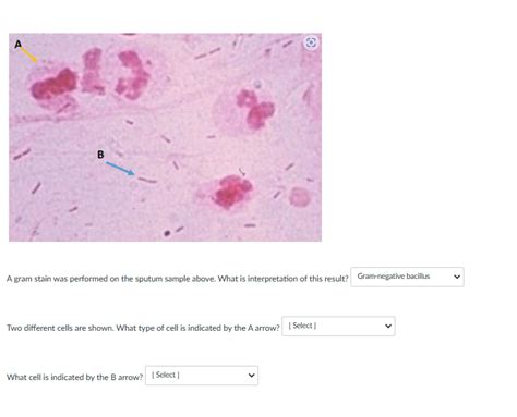 Solved A gram stain was performed on the sputum sample | Chegg.com