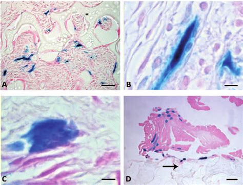 (a)–(d) Microscopic images of transgene expression of b -galactosidase... | Download Scientific ...