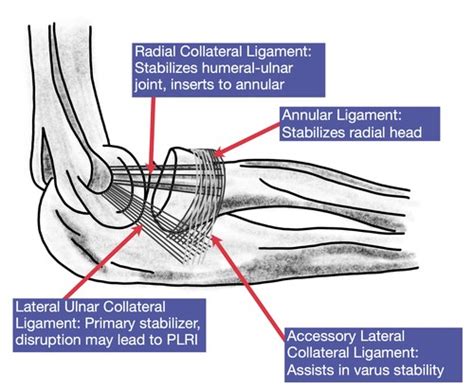 Elbow LCL Treatment | Hand Therapy Academy