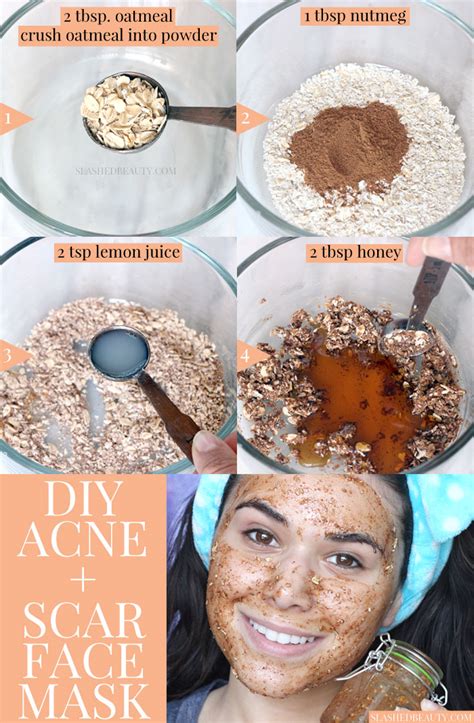 Best DIY Face Mask for Acne & Scars | Slashed Beauty