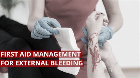 First Aid Management for External Bleeding #FirstAid #Lifesaver - YouTube