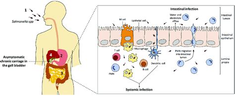 Salmonella Sepsis