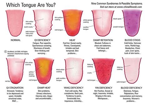 Which tongue are you?? When a TCM practitioner examines the tongue they are looking at such ...