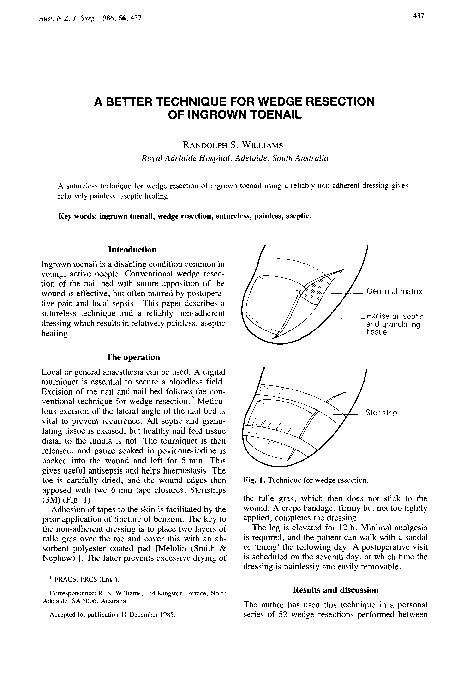 (PDF) A Better Technique for Wedge Resection of Ingrown Toenail | Randolph Williams - Academia.edu