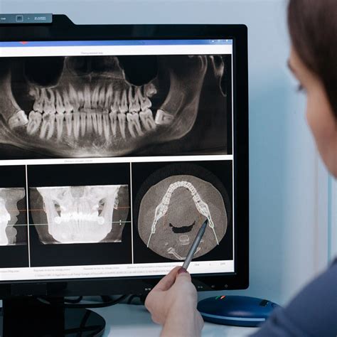 Dental Imaging Explained | Orthodontic Associates