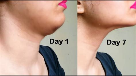 Get Rid of Double Chin | Easy Jawline Face Exercise To Reduce Face Fat ...