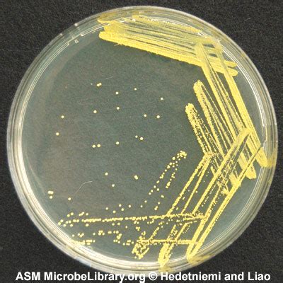 Isolated Colonies of Micrococcus luteus