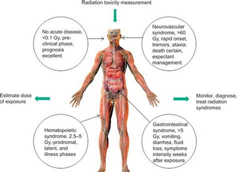 Acute radiation sickness signs, symptoms, causes, diagnosis & treatment