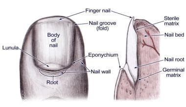 Nail Bed Laceration Repair: Overview, Indications, Contraindications