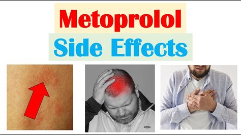 Metoprolol (& Beta Blockers) Side Effects (& Why They Occur) - YouTube