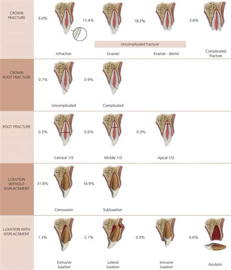 Crown Fracture Classification