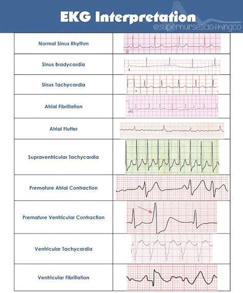 EKG Interpretation Nursing School Studying, Nursing School Notes, Nursing Study, Nursing Tips ...