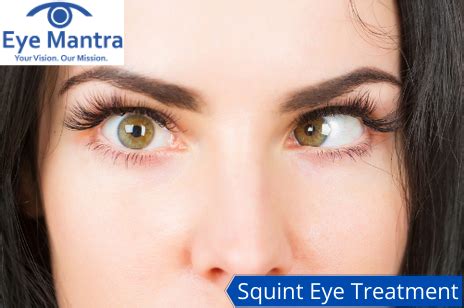 Squint Eye Treatment for Adults | Causes and Risks | Eyemantra