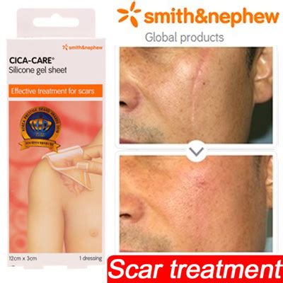 Qoo10 - [SMITH NEPHEW] Cica-Care Silicone Gel Sheeting / Burn scar removal / S... : Skin Care